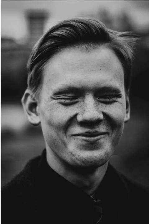 Vorher Nachher Face